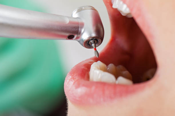 Best Broken Tooth Emergency  in Seaman, OH